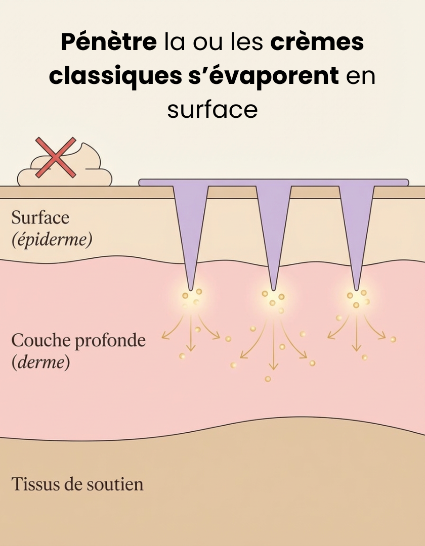 PATCH YEUX MICRO AIGUILLES